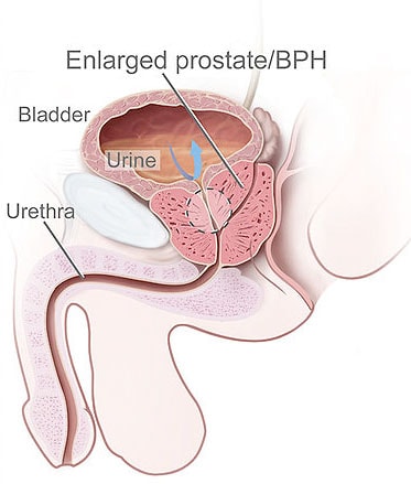 Stages-of-the-Pathology-Development